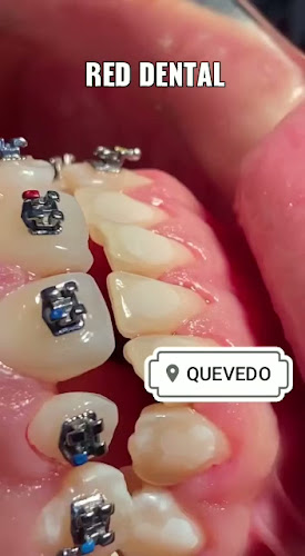 Opiniones de RED Rehabilitación Estetica Dental (QUEVEDO) en Quevedo - Dentista