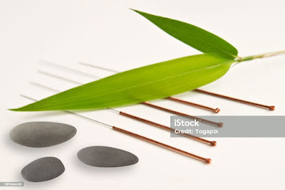 Cabinet d'Acupuncture - Médecine Traditionnelle Chinoise à Moisdon-la-Rivière
