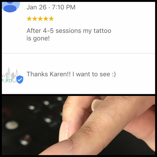 Explore lover tattoo ideas, creative tattoo ideas in Middle Village, available at Bye Bye Ink Laser Tattoo Removal