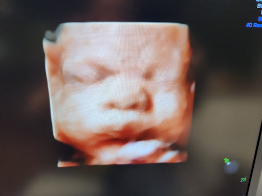 Baby Wave 4D Ultrasound image