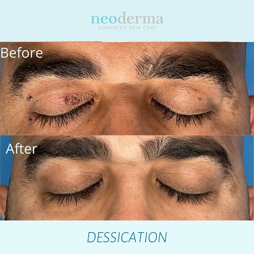 Explore slave tattoo ideas, creative tattoo ideas in Anaheim, available at Neoderma