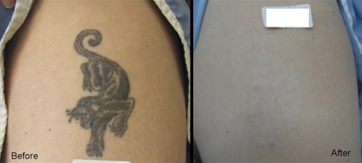 Explore christian tattoo sleeve ideas, creative tattoo ideas in Southampton, available at Laser & Skin Surgery Center of New York - Southampton