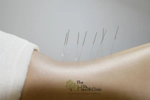 The Hills Health Clinic Acupuncture & Herbal Medicine image