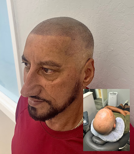 Explore denver tattoo ideas, creative tattoo ideas in Roseville, available at NuHair Ink. Scalp MicroPigmentation & Aesthetic Clinic of Sacramento