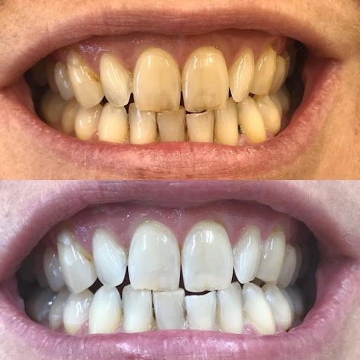 Dental Perfection Coventry
