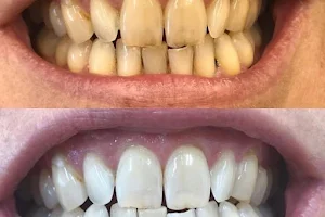 Dental Perfection Coventry image