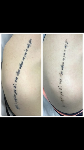 Explore texas longhorn tattoo ideas, creative tattoo ideas in Royal Oak, available at Removery Tattoo Removal & Fading