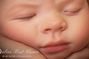 Babies First Glance - 8K 5D/4D/3D & Gender Ultrasounds image