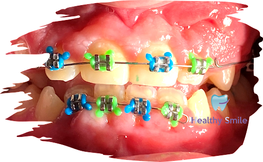 Healthy Smile