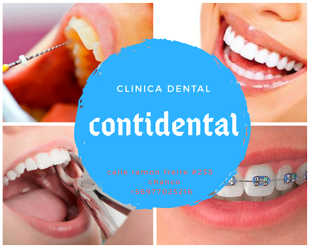 Comentarios y opiniones de Clinica Dental Contidental