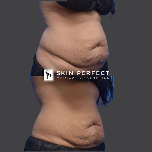 Explore everything happens for a reason tattoo ideas, creative tattoo ideas in Whittier, available at Skin Perfect Medical Aesthetics