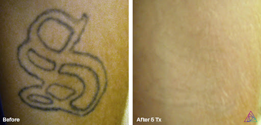 Find sapphic tattoo ideas for your next unique tattoo in Fort Myers at Laser Tattoo Removal by Tatt Cemetery