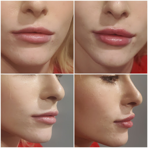 Explore 20th anniversary tattoo ideas, creative tattoo ideas in Portland, available at Oregon Medical & Laser (formerly Cascade Medical & Tattoo Removal)