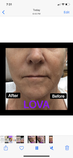 Explore tattoo ideas stencils, creative tattoo ideas in Lake Oswego, available at Lake Oswego Vein and Aesthetic LOVA