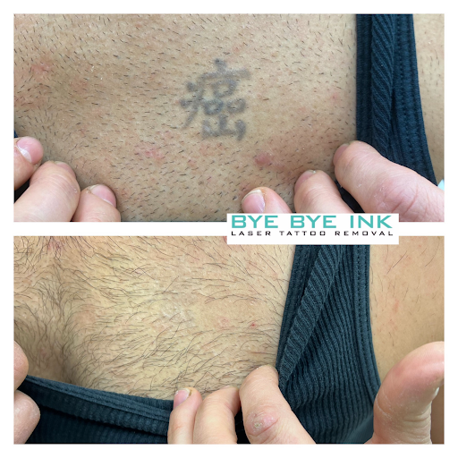 Explore ideas girly pretty hand tattoos, creative tattoo ideas in Middle Village, available at Bye Bye Ink Laser Tattoo Removal