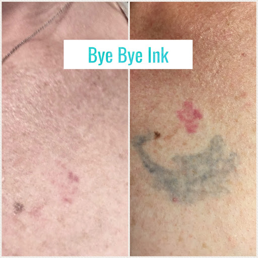 Explore bts love yourself tattoo ideas, creative tattoo ideas in Middle Village, available at Bye Bye Ink Laser Tattoo Removal