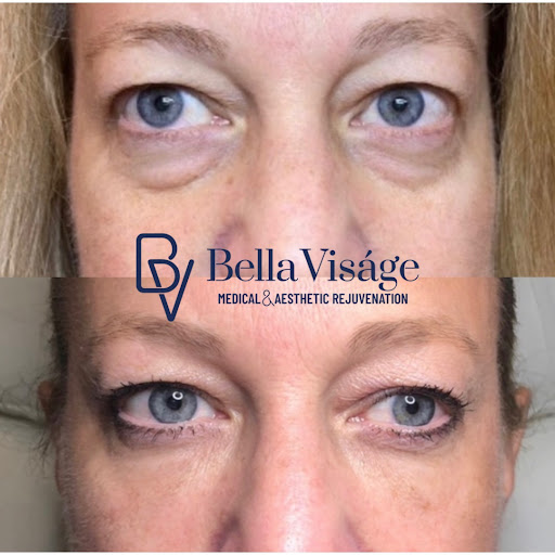 Explore tattoo ideas female side, creative tattoo ideas in Lakeland, available at Bella Visge Medical & Aesthetic Rejuvenation