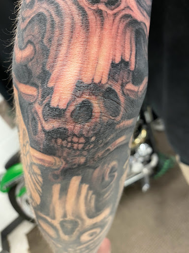 Explore knee surgery tattoo ideas, creative tattoo ideas in Orland, available at K1LL3R ARTW0RK