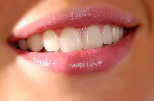 Dental Implant Clinic Antwerp | Dental Clinics Group