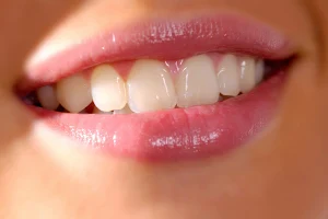Dental Implant Clinic Antwerp | Dental Clinics Group image