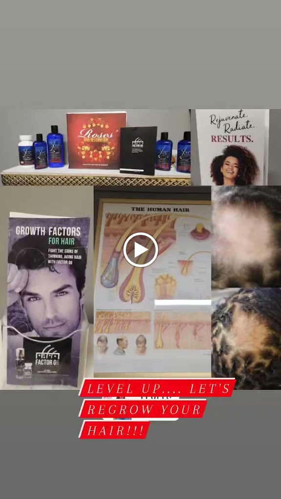 Roses' Hair Restoration Clinic 45246