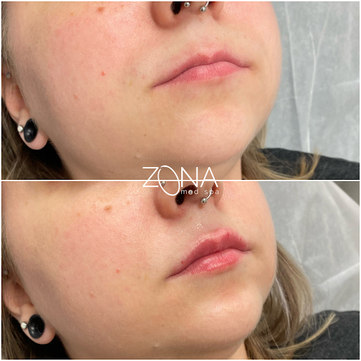 Skin Care Clinic «ZONA MED SPA», reviews and photos, 9767 N 91st St #102, Scottsdale, AZ 85258, USA