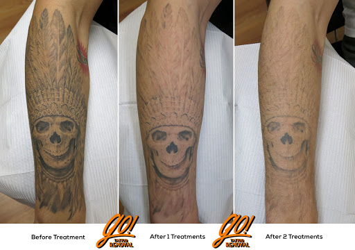 Explore tattoo ideas for soulmates, creative tattoo ideas in Allentown, available at Removery Tattoo Removal & Fading