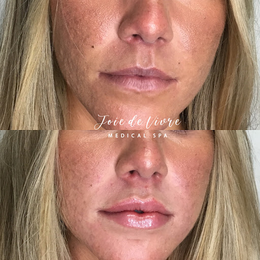 Explore cheap tattoo ideas for guys, creative tattoo ideas in Canton, available at JDV Med Spa