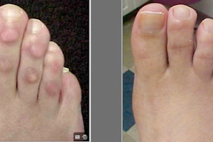 Bunion, Flat Foot, Heel Pain, Neuroma Surgeons image