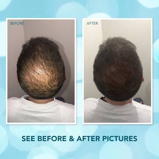 Hair Replacement Service «Foundation For Hair Restoration», reviews and photos, 6280 Sunset Dr #504, Miami, FL 33143, USA