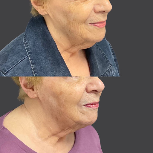 Explore simple cute tattoos ideas, creative tattoo ideas in Whittier, available at Skin Perfect Medical Aesthetics