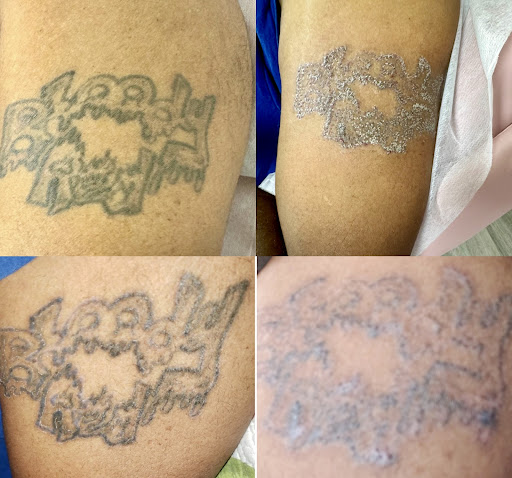 Explore botanical tattoo ideas, creative tattoo ideas in Savannah, available at Haute Brows. Cosmetic Tattoo