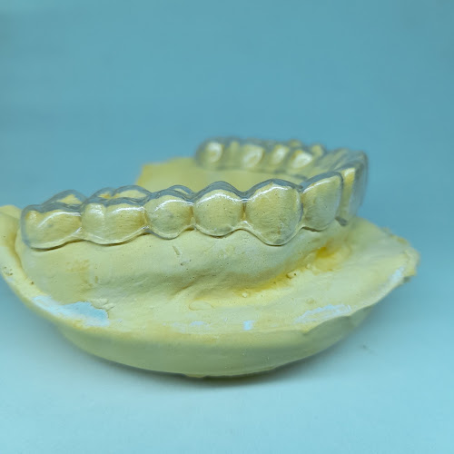 Comentarios y opiniones de LABORATORIO I-DENTAL / Prótesis Dentales /Prótesis Acrílicas - Metálicas y Flexibles/ Planos de Relajación/ Reparaciones Dentales a domicilio/ Mecánico Dental