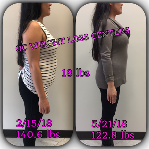 OC Weight Loss Centers & CoolSculpting image