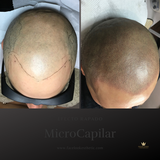 Facelook esthetic scalp clinic Sede Trujillo