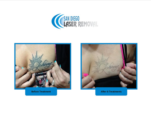 Explore colored tattoo ideas for men, creative tattoo ideas in San Diego, available at Removery Tattoo Removal & Fading