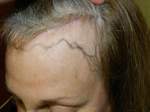 Hair Replacement Service «Medical Hair Transplants & Aesthetics», reviews and photos, 15055 Los Gatos Blvd Suite #110, Los Gatos, CA 95032, USA