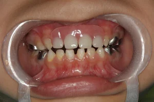 KidzSmile Dental Center image