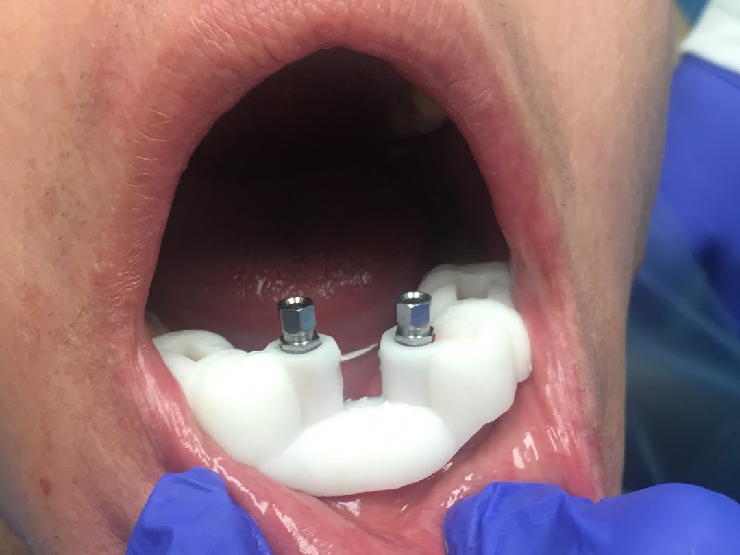 Miami Implant & Family Dentists