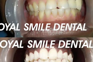 ROYAL SMILE DENTAL CLINIC,BRACES & IMPLANT CENTRE| BEST DENTAL CLINIC|CERTIFIED INVISALIGN PROVIDER| 3D ITERO SCANNING CENTRE image