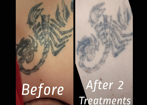 Explore womens shoulder tattoo ideas, creative tattoo ideas in Brighton, available at Tip of the Spear Laser Esthetics