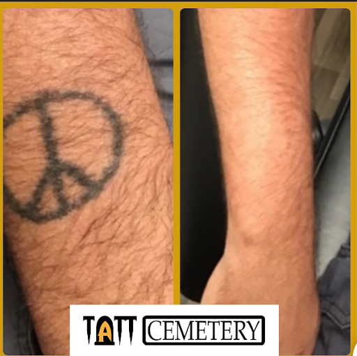 Explore animal tattoo ideas for guys, creative tattoo ideas in Fort Myers, available at Laser Tattoo Removal by Tatt Cemetery