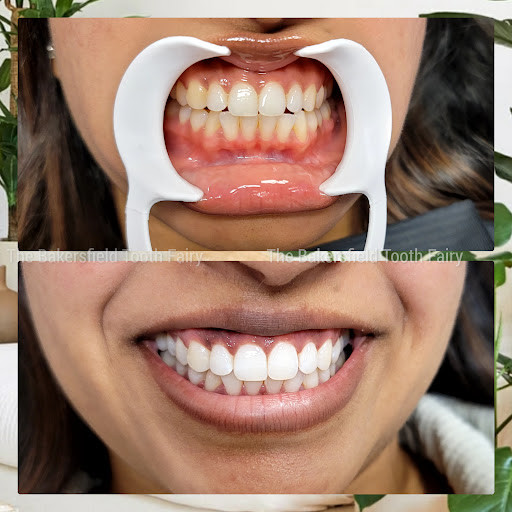 Explore medium sized tattoo ideas, creative tattoo ideas in Bakersfield, available at Skin Kings Tattoo