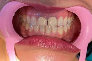 Clinica Dental - Dentaliz (DENTALLI) - Ortodoncia - Dentistas en Ometepec - Dentistas Guerrero image