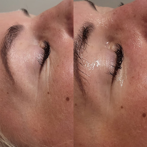 Rejuvenate Skincare Aesthetics - Rejuvenate Skincare Aesthetics