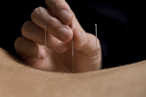 Amanda Silcock - Acupuncture in York