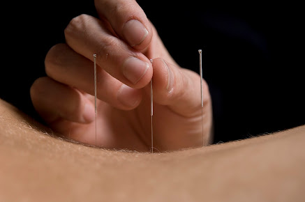 Amanda Silcock - Acupuncture in York - Amanda Silcock - Acupuncture in York