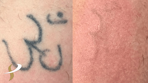 Explore swiss tattoo ideas, creative tattoo ideas in Spokane, available at Premier Body and Laser