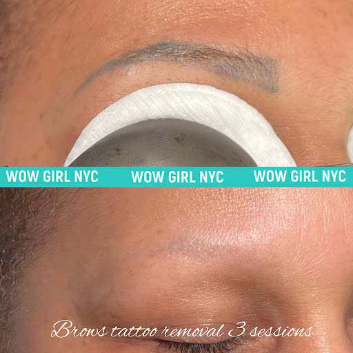 Explore surreal tattoo ideas, creative tattoo ideas in New York, available at WOW LASER NYC Tattoo removal in New York