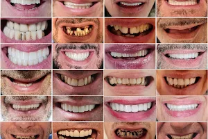 Impianti Dentali Albania - Dentisti in Albania - Oxa Clinic image